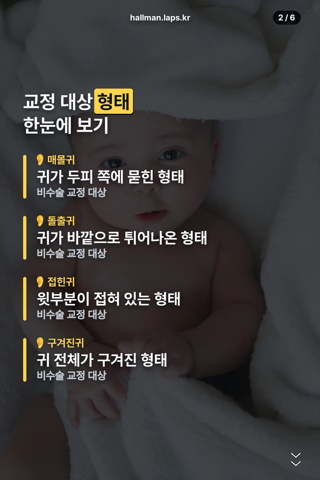 교정 대상 형태